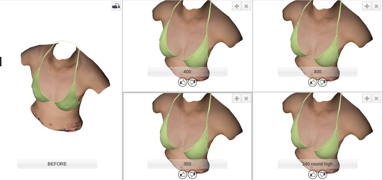 3D scanner ทำนม